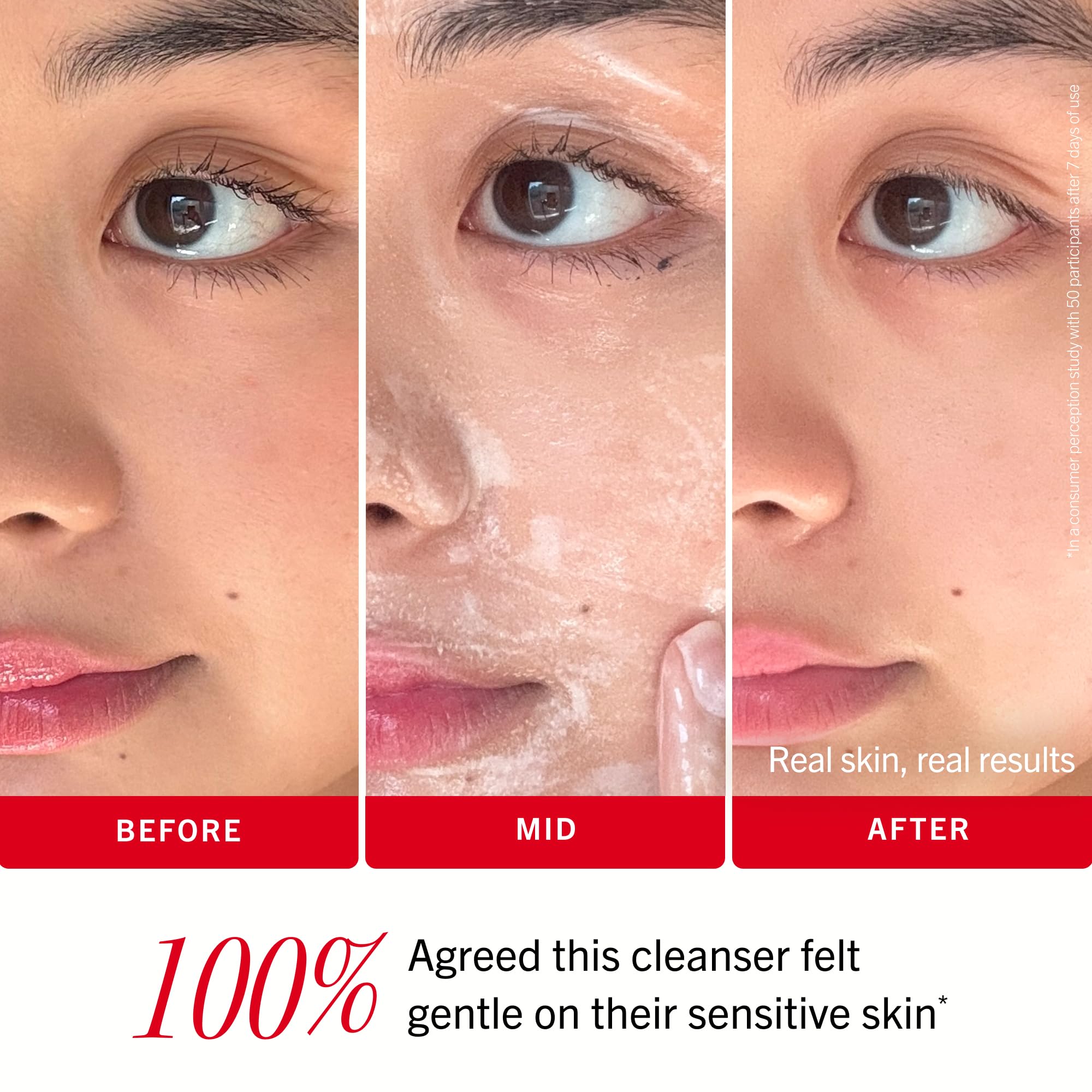 First Aid Beauty Cleansers Pure Skin detergente viso 170 g sensibili
