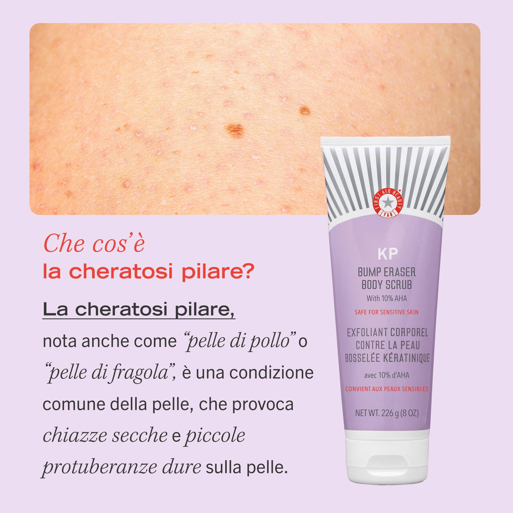 First Aid Beauty KP Bump Eraser Scrub Corpo 226g 10% AHA