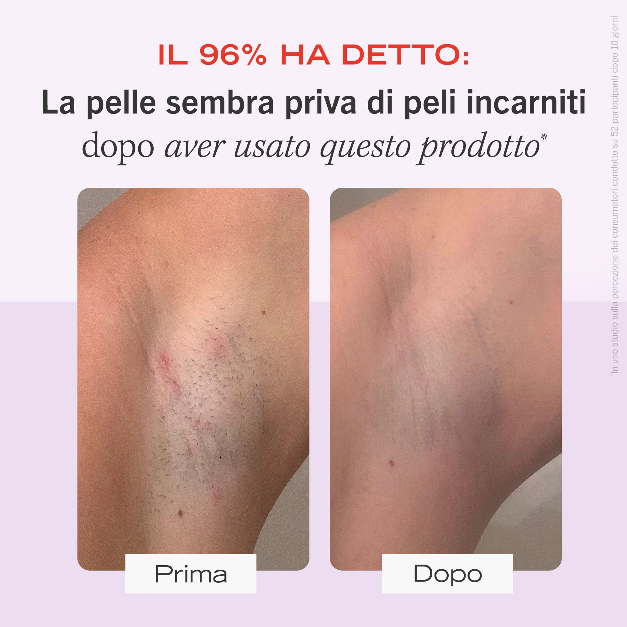 First Aid Beauty Ingrown Hair 28 pads BHA AHA peli incarniti