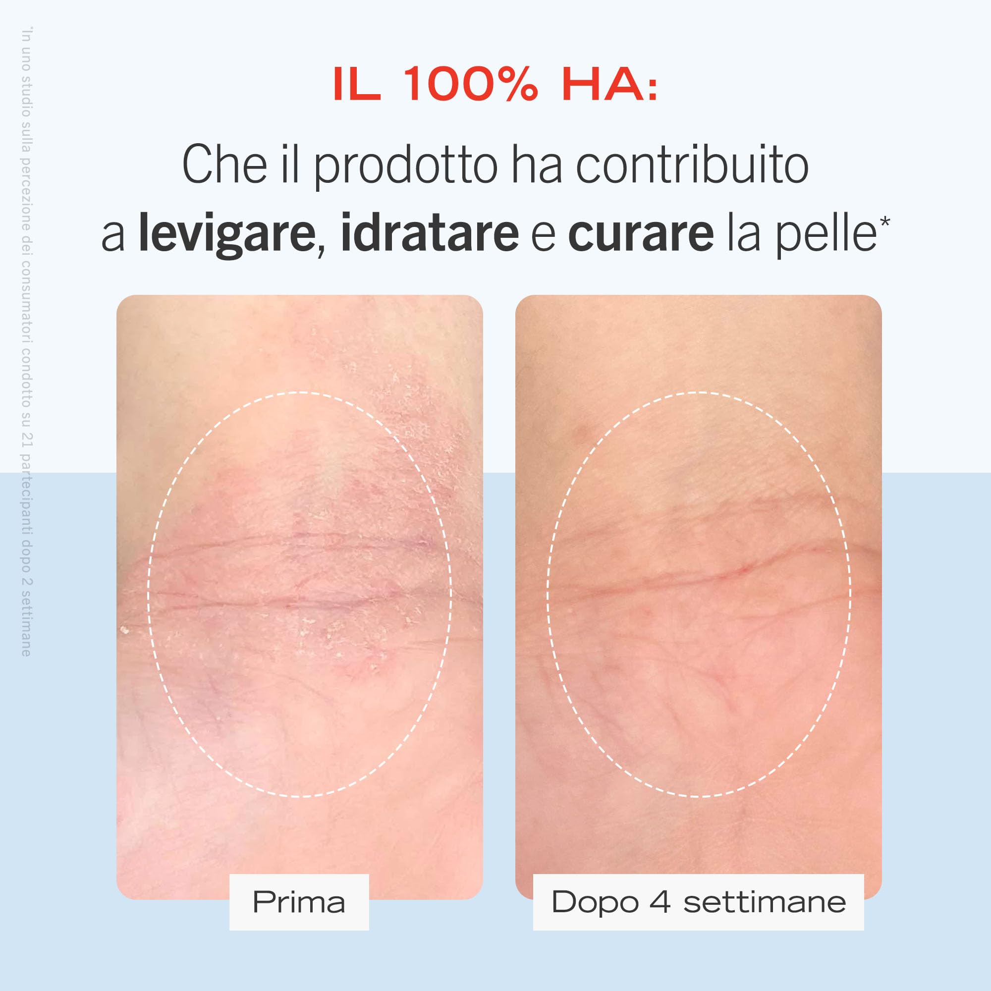 First Aid Beauty Ultra Repair crema viso corpo 170g secca