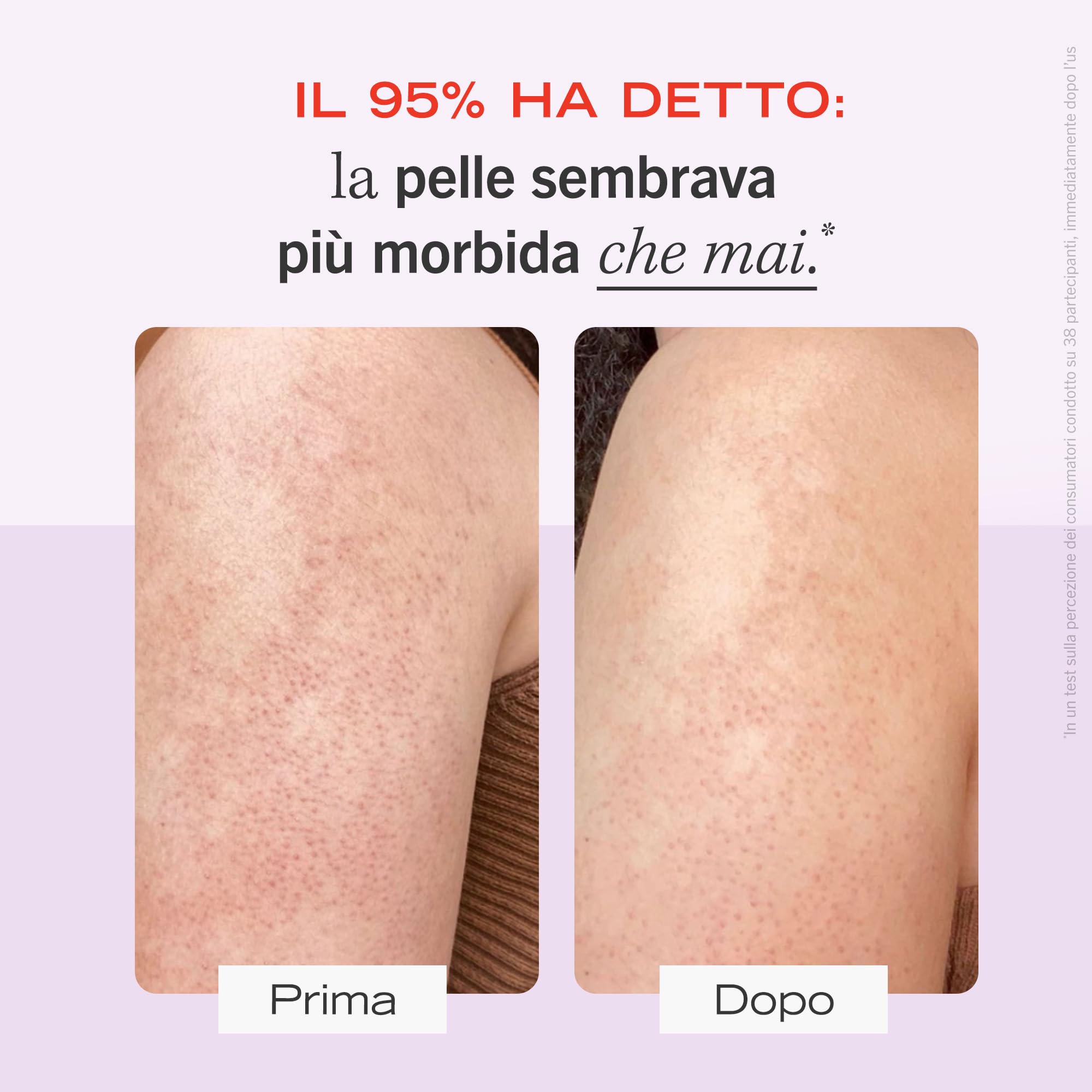 First Aid Beauty KP Bump Eraser Scrub Corpo 226g 10% AHA